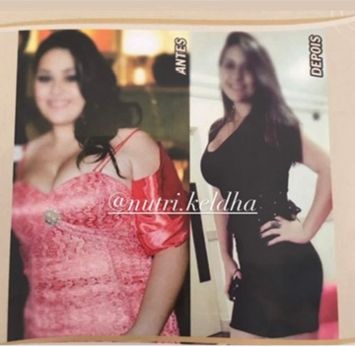 Resultado paciente - Antes e Depois