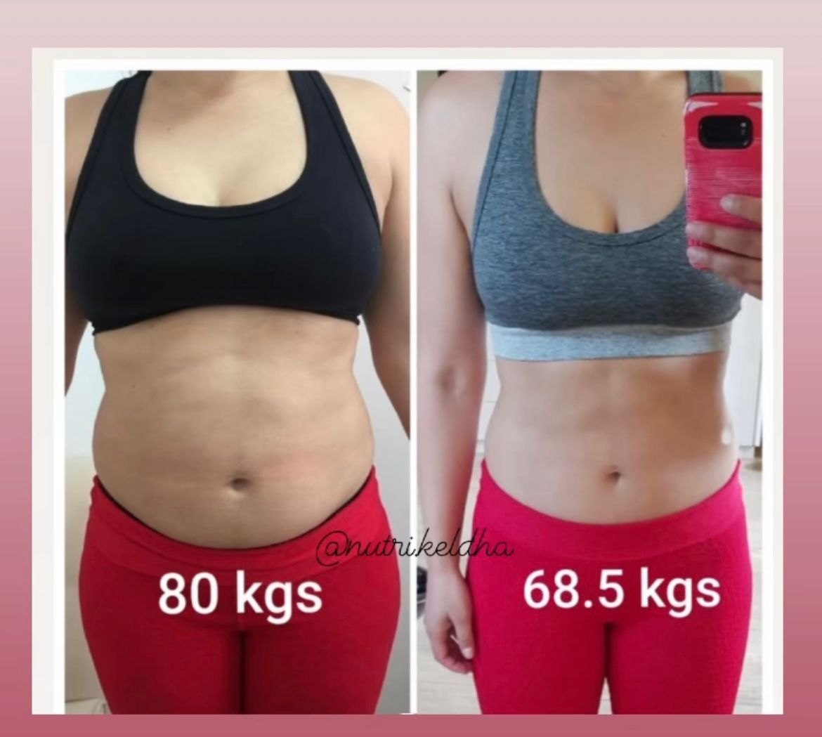 Resultado paciente - 80kg para 68.5kg