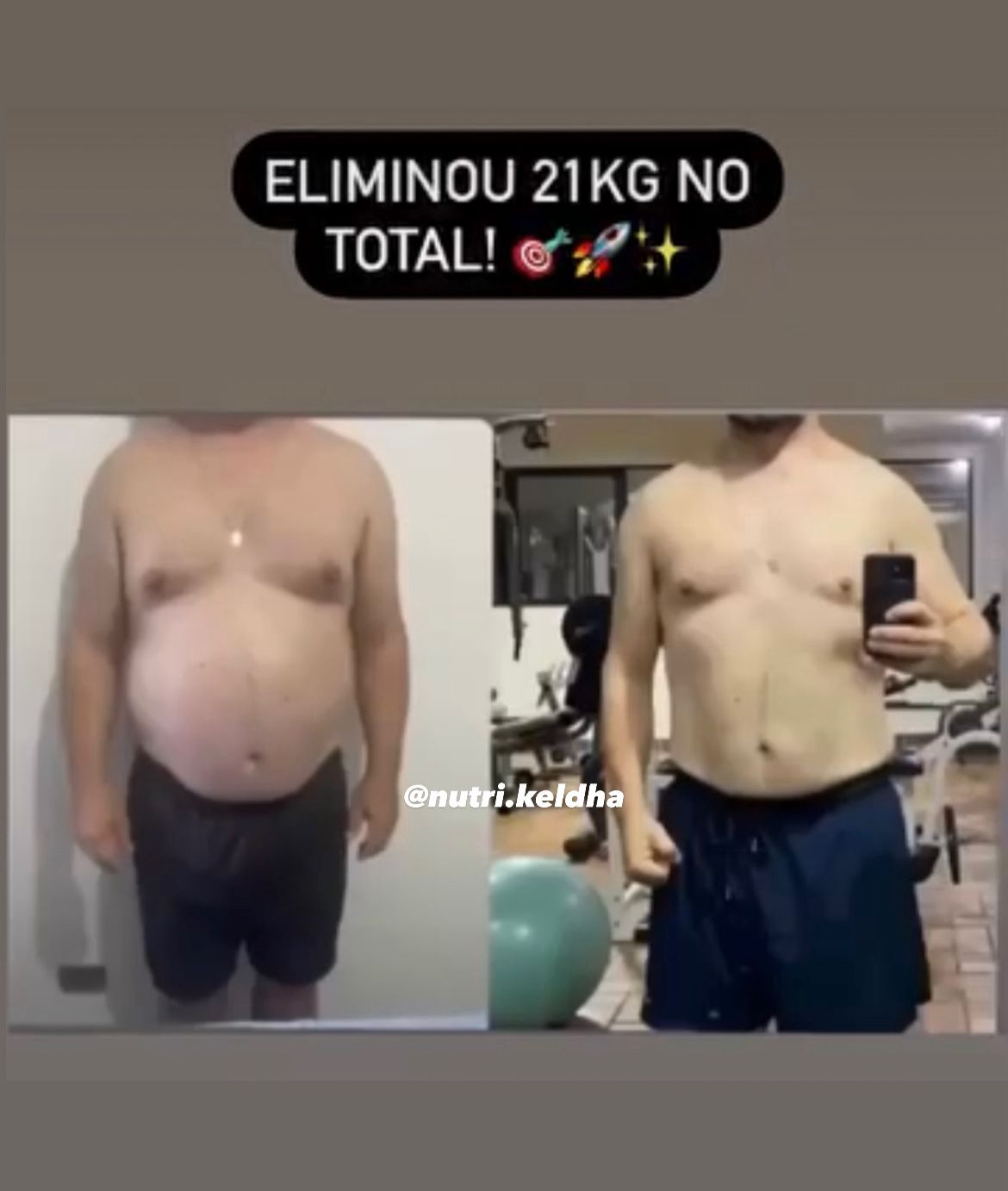 Resultado paciente - Eliminou 21kg