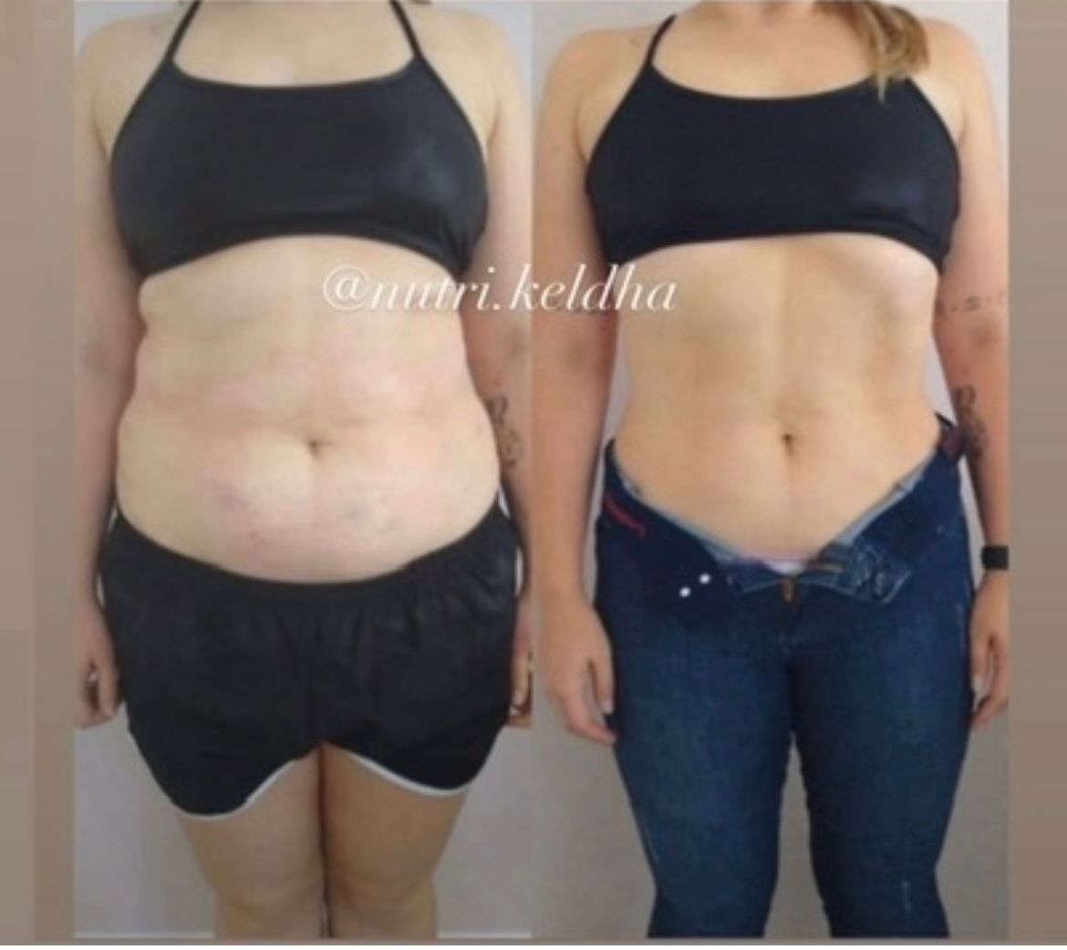 Resultado paciente - Antes e Depois